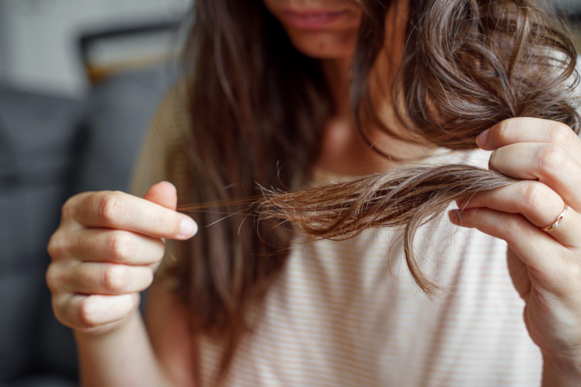 illegal drugs that cause hair loss